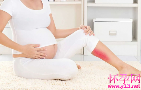 孕期腿疼一定是缺钙吗？该如何缓解呢？